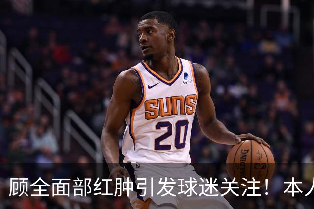 顾全面部红肿引发球迷关注！本人解释是多年皮肤问题并非外伤伤疤